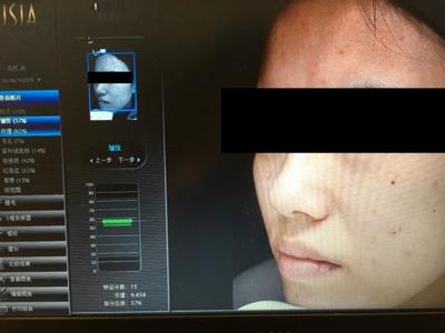 皮膚檢測儀哪家強(qiáng)？Visia、美圖宜膚、A-one實測深度對比
