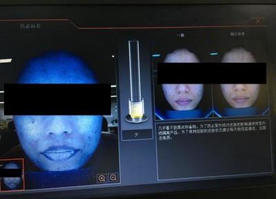 皮膚檢測儀深度實測 Visia、美圖宜膚、A-one究竟哪家強(qiáng)？